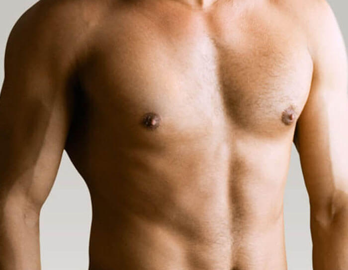 Picture of a man's chest showing the flatness achieved after a Gynecomastia male breast reduction.