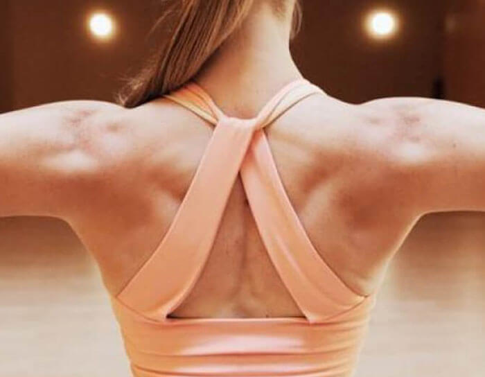 Picture of a woman's upper back showing the effect of a bra line and armpits liposuction.